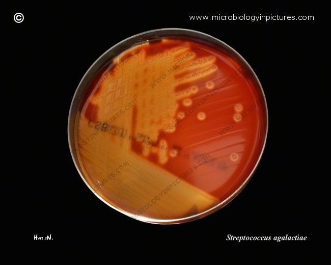 streptococcus agalactiae, beta-hemolysis